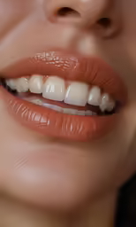 a womans mouth is shown with dental equipment