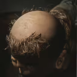 a man with long hair has a strange looking object in his head